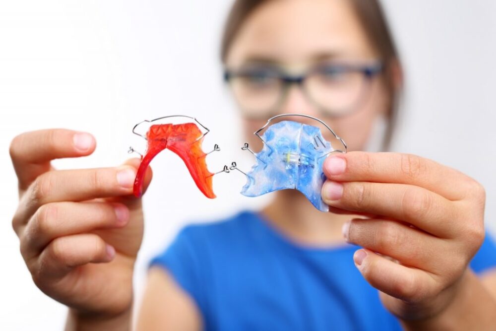 Πότε το οδοντικό δέσιμο θεωρείται βασική απαίτηση;