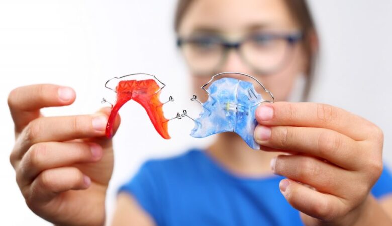 Πότε το οδοντικό δέσιμο θεωρείται βασική απαίτηση;