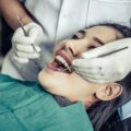 Πώς λειτουργούν τα οδοντικά σφραγιστικά και ποιος είναι ο ρόλος τους στην πρόληψη της τερηδόνας;