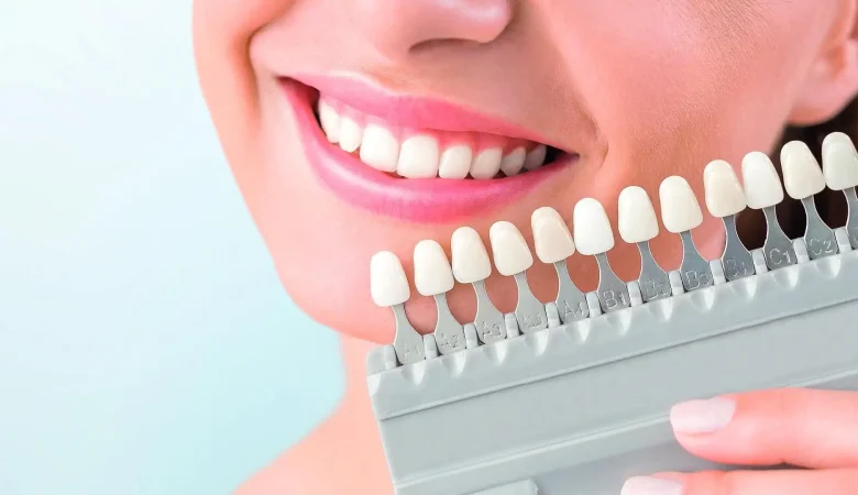 Πώς οι σύνθετες θεραπείες λευκαίνουν τα δόντια σας για σίγουρη εμφάνιση