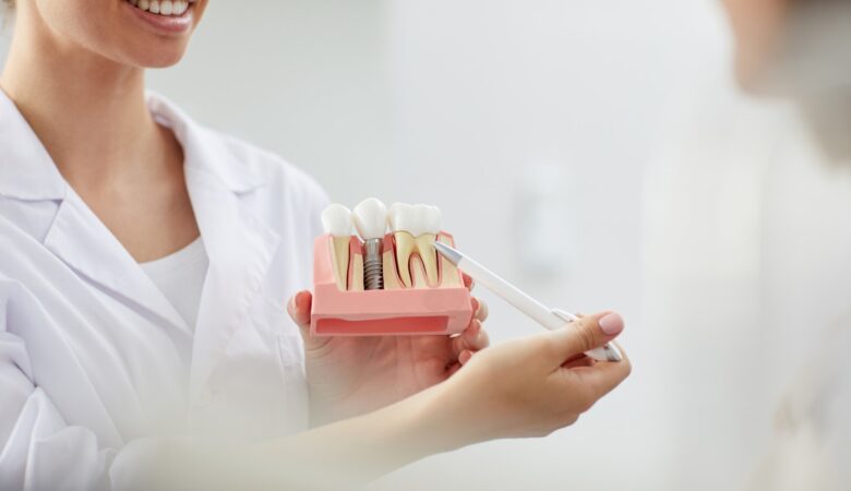 Πώς μπορώ να ξέρω αν χρειάζομαι οδοντικά εμφυτεύματα;